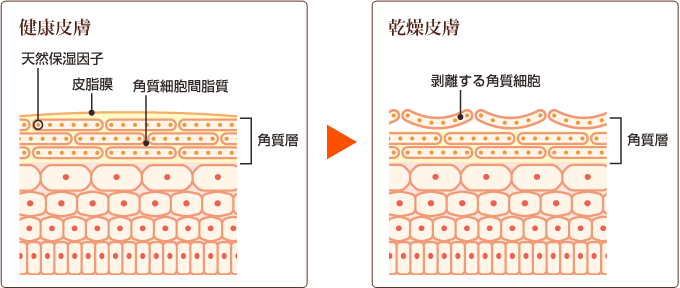 健康皮膚 乾燥皮膚
